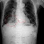 Can Artificial Intelligence effectively and ethically detect COVID-19?
