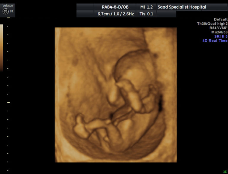 28 week 4d ultrasound boy